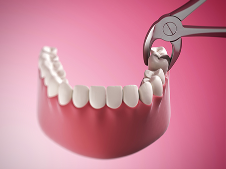 North Georgia Oral Surgeon