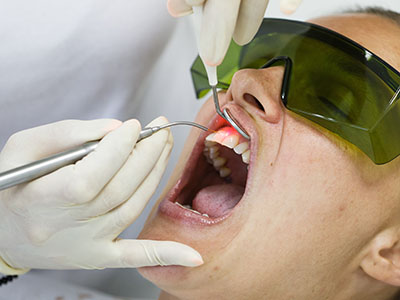 North Georgia Oral Surgeon | Laser Dentistry, Inlays  amp  Onlays and Fluoride Treatment
