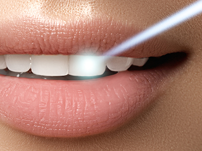 North Georgia Oral Surgeon | Dental Sealants, Dermal Fillers and Ceramic Crowns